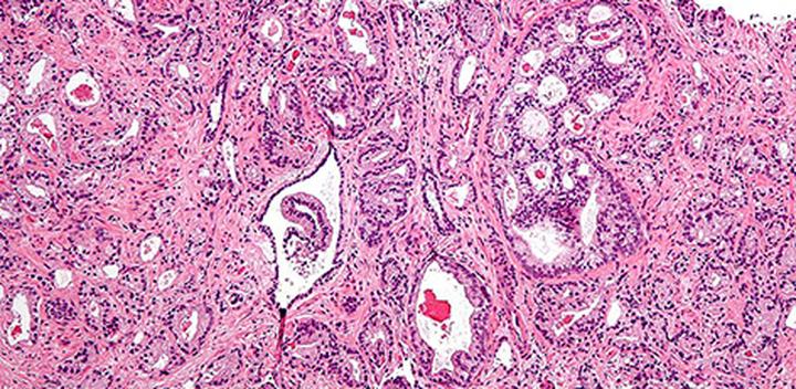 Wynik histopatologiczny