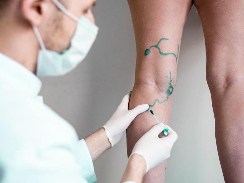 Leczenie chorób naczyniowych