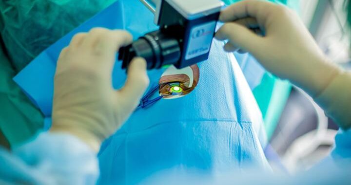 Cross Linking – Klucz do Rozwiązania Problemów z Rogówką? Sprawdź, Jak Działa!