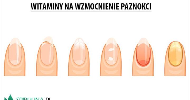 Skuteczne sposoby na to, jak wzmocnić paznokcie i cieszyć się zdrowym wyglądem
