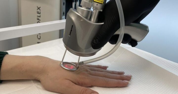 Frakcyjne odmładzanie twarzy: Nowoczesna metoda na piękniejszą skórę, którą warto poznać