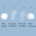 Żółty śluz w ciąży: Co oznacza, przyczyny i kiedy warto się zmartwić?